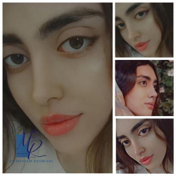 جراحی-بینی-112