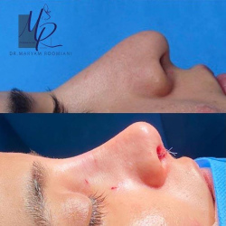 جراحی-بینی-123