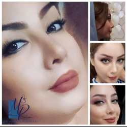 جراحی-بینی-58