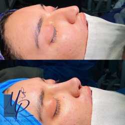 جراحی-بینی-72