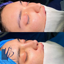 جراحی-بینی-73