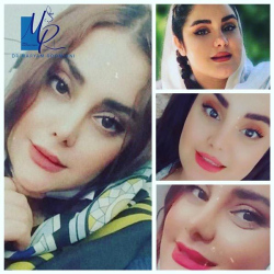 جراحی-بینی-78