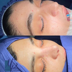 جراحی-بینی-85