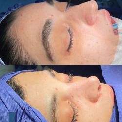 جراحی-بینی-86