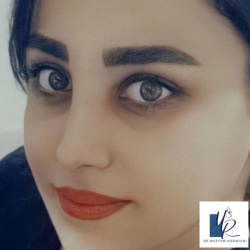 جراحی-بینی-90