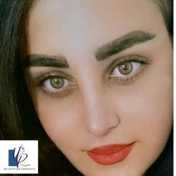 جراحی-بینی-91