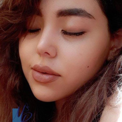 جراحی-بینی-99