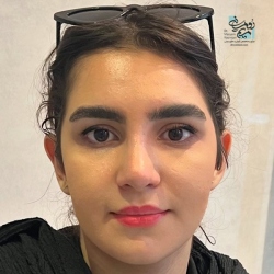 Rhinoplasty-17