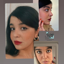 Rhinoplasty-27