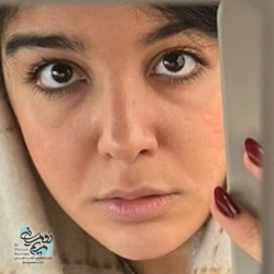 Rhinoplasty-30
