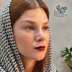 Rhinoplasty-38