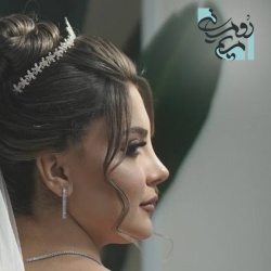 Rhinoplasty-66