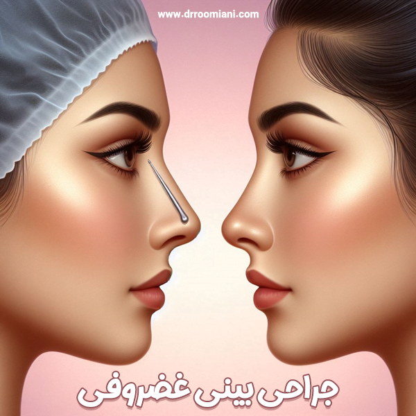جراحی بینی غضروفی - دکتر مریم رومیانی