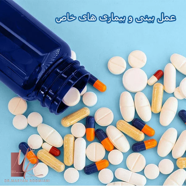 عمل بینی و بیماری های خاص - دکتر رومیانی