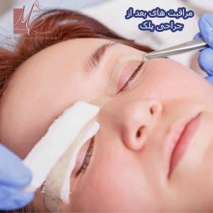مراقبت های بعد از جراحی پلک - دکتر رومیانی