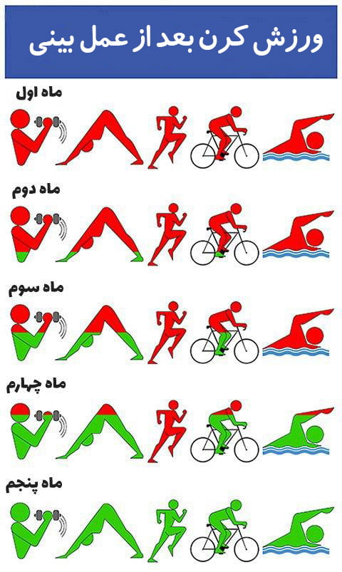 ورزش کردن بعد از عمل بینی - دکتر رومیانی
