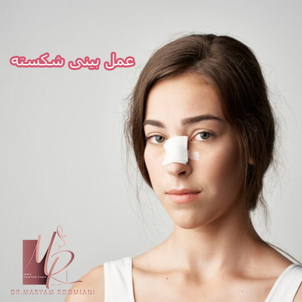عمل بینی شکسته - دکتر رومیانی