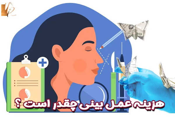 هزینه جراحی بینی