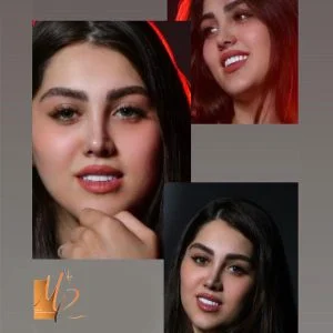 نمونه کار جراحی بینی در تهران