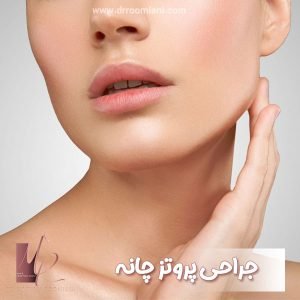 جراحی پروتز چانه - دکتر مریم رومیانی