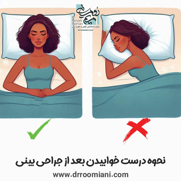مراقبت های بعد از جراحی بینی - دکتر مریم رومیانی