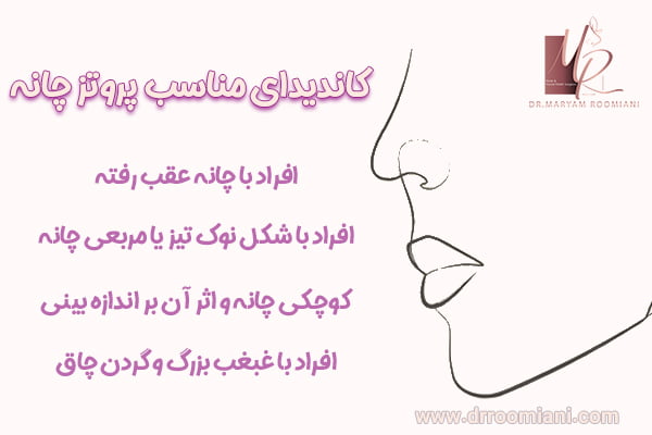 جراحی پروتز چانه - دکتر مریم رومیانی