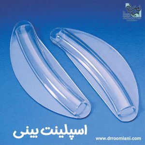 اسپلینت بینی - دکتر مریم رومیانی