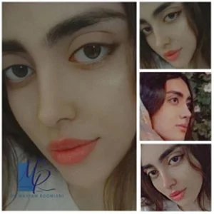 جراحی بینی در تهران - دکتر مریم رومیانی