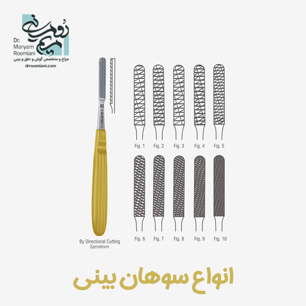 سوهان کشیدن بینی + دکتر مریم رومیانی