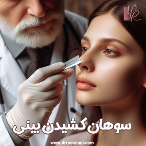سوهان کشیدن بینی - دکتر مریم رومیانی