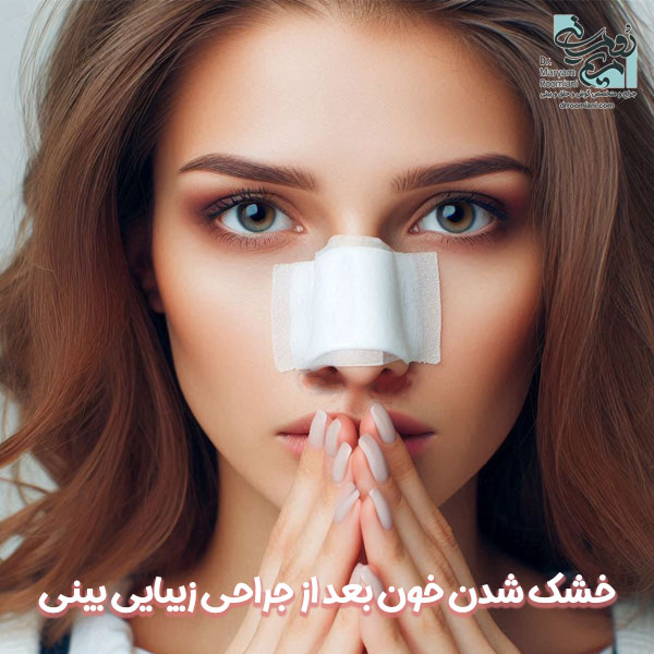 خشک شدن خون بعد از جراحی زیبایی بینی - دکتر مریم رومیانی