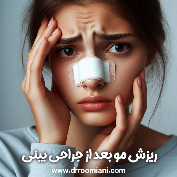 ریزش مو بعد از جراحی بینی + دکتر مریم رومیانی