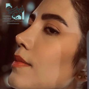 بهترین جراح بینی تهران - دکتر مریم رومیانی