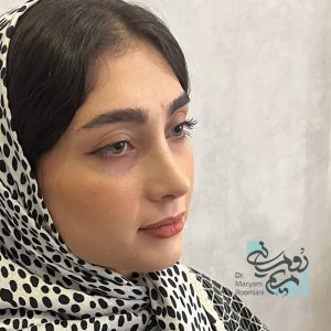 بهترین جراح بینی تهران - دکتر مریم رومیانی