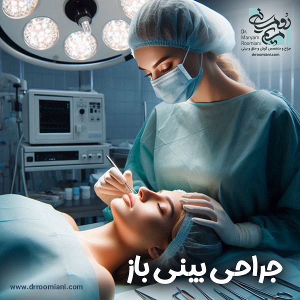 جراحی بینی باز در تهران + دکتر مریم رومیانی
