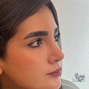 بهترین جراح بینی تهران - دکتر مریم رومیانی