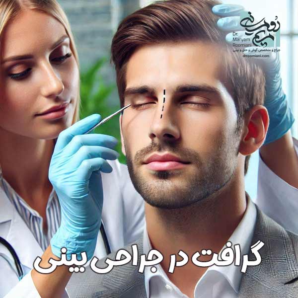 گرافت در جراحی بینی + دکتر مریم رومیانی