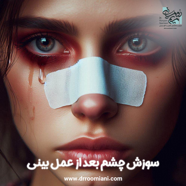 علت سوزش چشم بعد از عمل بینی + دکتر مریم رومیانی