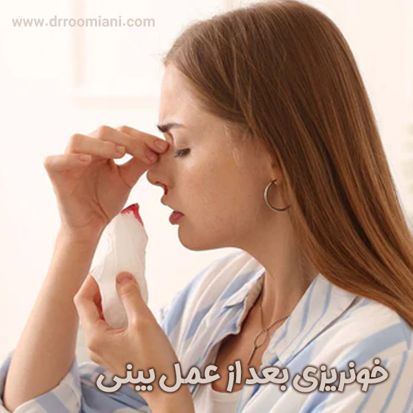 خونریزی بعد از عمل بینی + دکتر مریم رومیانی