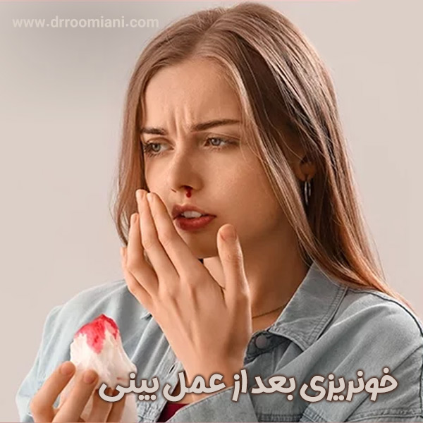خونریزی بعد از عمل بینی + دکتر مریم رومیانی
