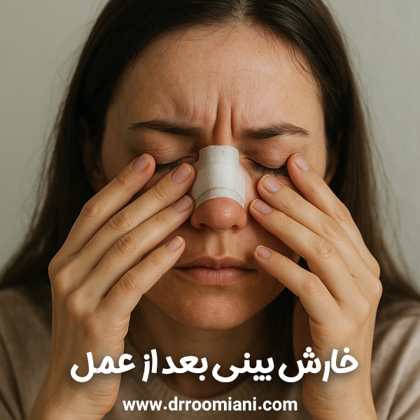 خارش بینی بعد از عمل + دکتر مریم رومیانی