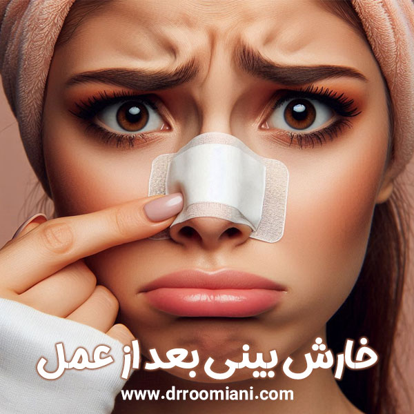 خارش بینی بعد از عمل + دکتر مریم رومیانی