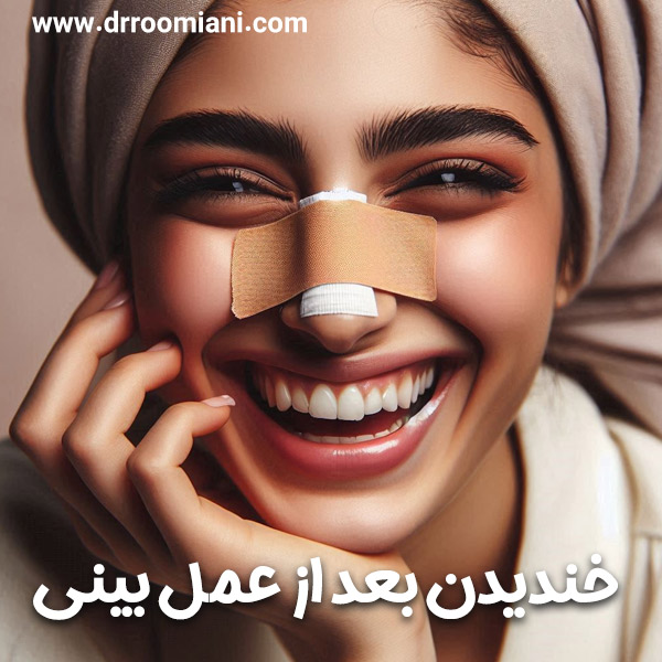 خندیدن بعد از عمل بینی + دکتر مریم رومیانی