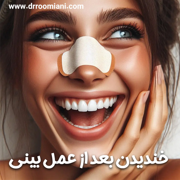 خندیدن بعد از عمل بینی + دکتر مریم رومیانی