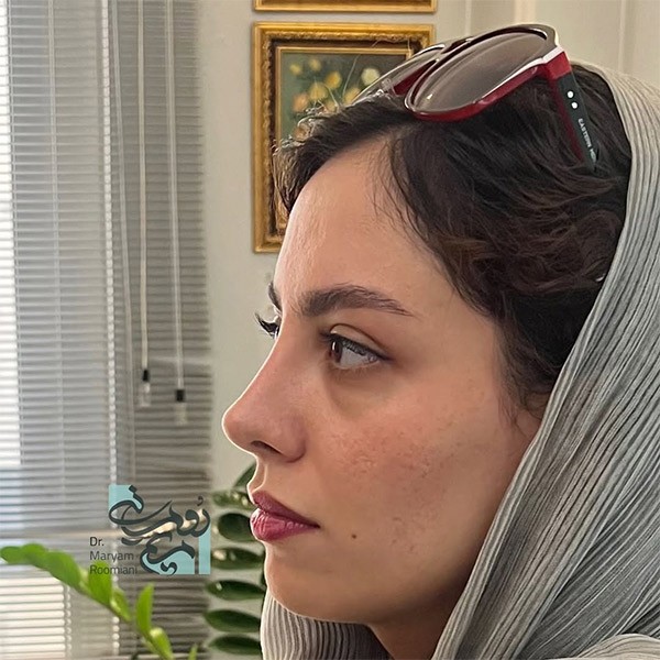 جراحی بینی طبیعی + دکتر مریم رومیانی