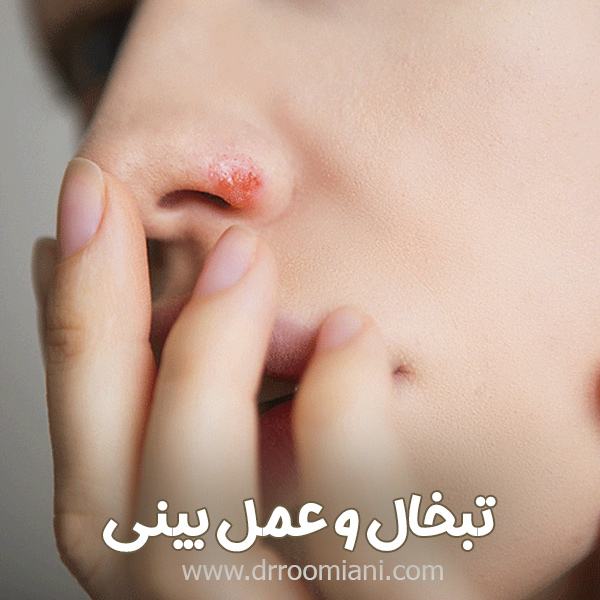 تبخال و عمل بینی + دکتر مریم رومیانی