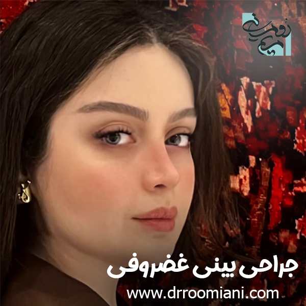 جراحی بینی غضروفی در تهران + دکتر مریم رومیانی