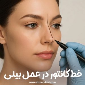 خط کانتور در عمل بینی + دکتر مریم رومیانی