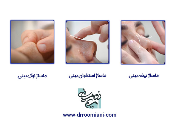 ماساژ بینی بعد از جراحی + دکتر مریم رومیانی
