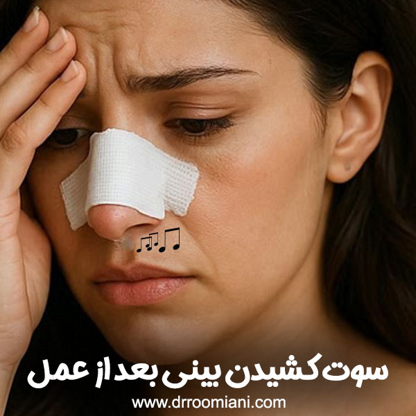 سوت کشیدن بینی بعد از عمل + دکتر مریم رومیانی